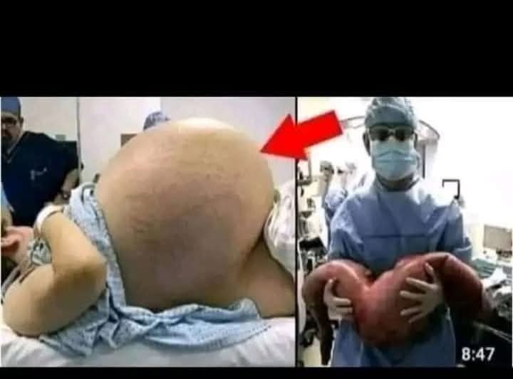 😱 She cried with happiness, they told her she was pregnant with triplets, but the… See more